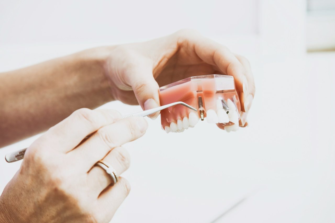 high quality denture repair process in lab