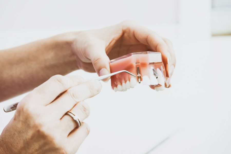 high quality denture repair process in lab